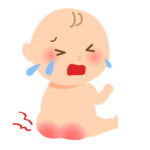 おむつかぶれ